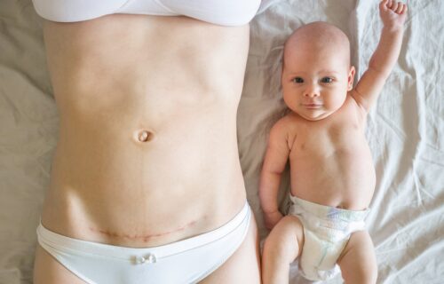 10 cuidados esenciales para la mamá tras una cesárea